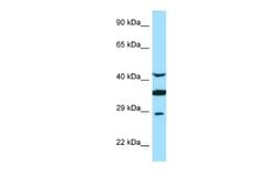 Torsin A Rabbit anti-Human, Polyclonal, Novus Biologicals 0.1ml; Unconjugated:Antibodies,